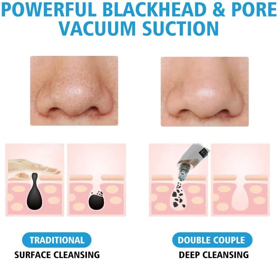 New Blackhead Remover Pore Vacuum, Upgraded Electric Facial Pore Cleaner with 5 Suction Power & 5 Probes, 4 Pimple Popper Tools, USB Rechargeable Blackhead Vacuum Kit for Women & Men