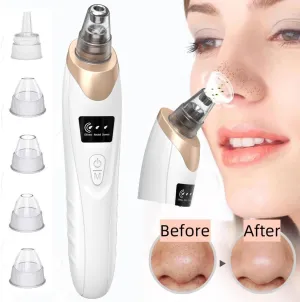 New Blackhead Remover Pore Vacuum, Upgraded Electric Facial Pore Cleaner with 5 Suction Power & 5 Probes, 4 Pimple Popper Tools, USB Rechargeable Blackhead Vacuum Kit for Women & Men