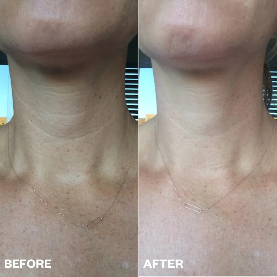 Serious Skin Smoothing Set